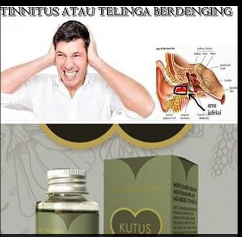 Minyak Kutus Kutus bisa Mengobati Sakit Telinga berdenging - Tinnitus