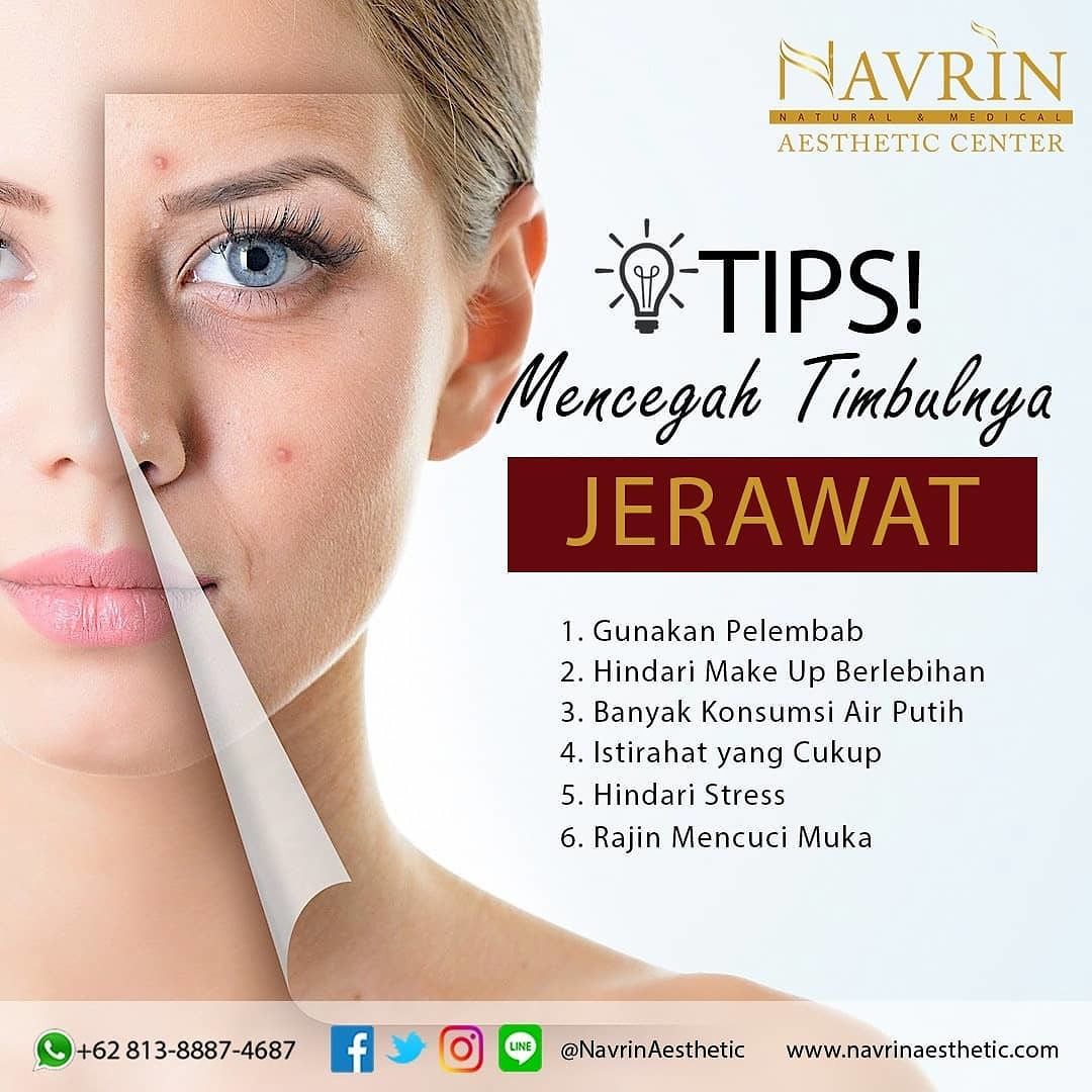 Tips Mencegah Jerawat