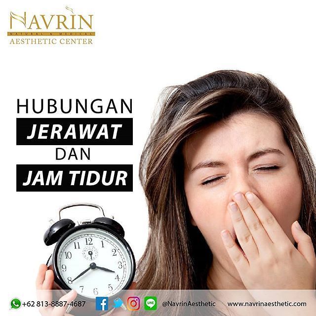 HUBUNGAN JERAWAT DAN JAM TIDUR