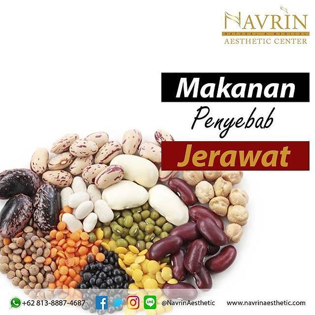 Makanan Penyebab Jerawat