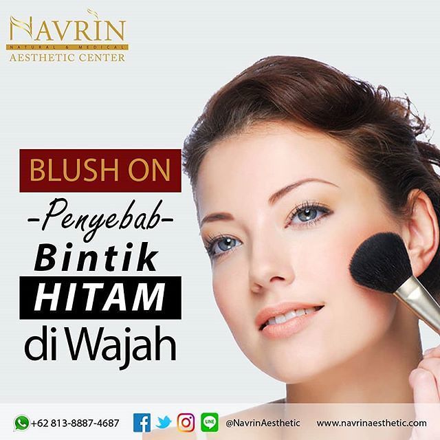 Penyebab Bintik Hitam Di Wajah