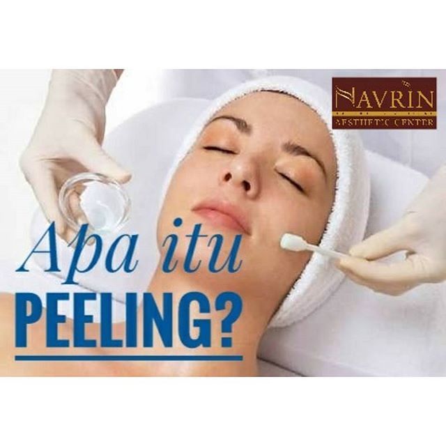 Peeling Wajah