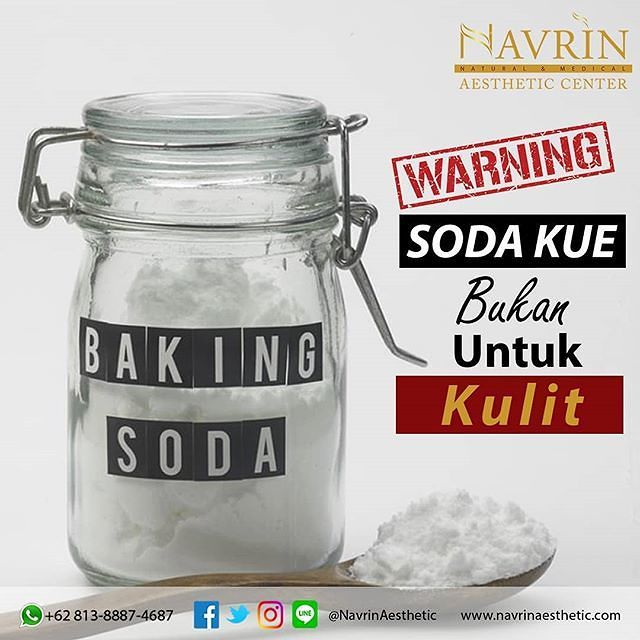 Bahaya soda kue bagi wajah