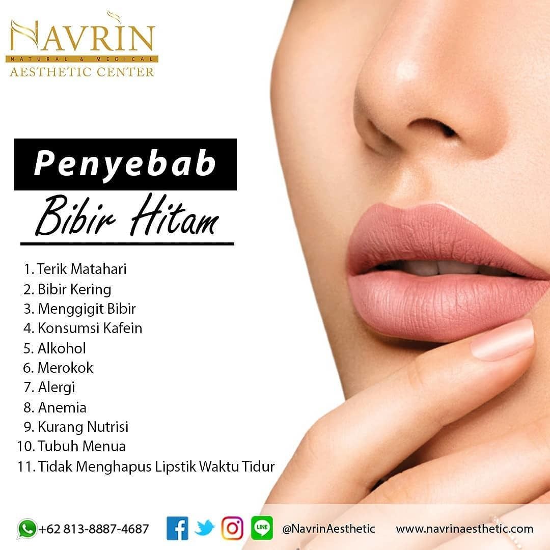  Kebiasaan Yang Bikin Bibir Jadi Hitam
