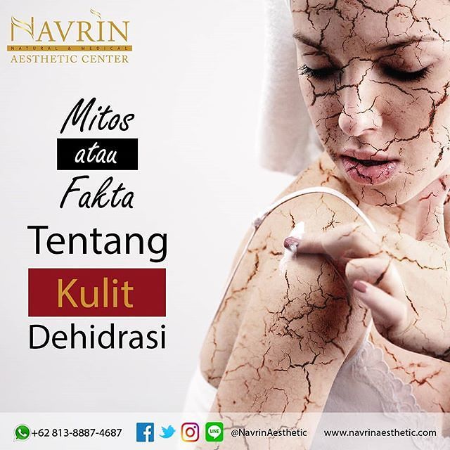 Mitos atau Fakta Tentang Kulit Dehidrasi