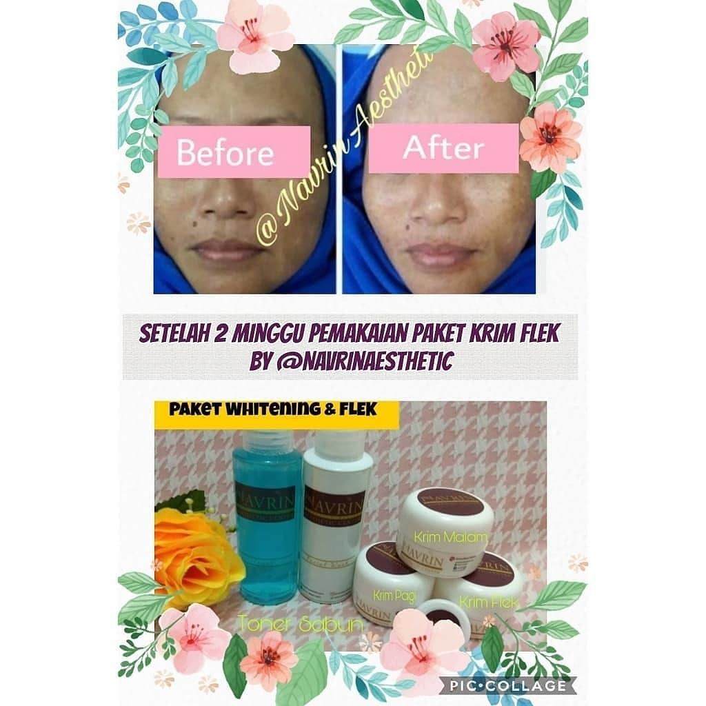 Krim Ampuh Pencerah Wajah