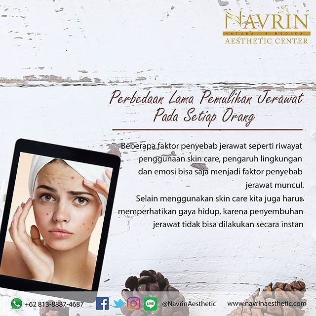 Perbedaan Lama Pemulihan Jerawat Pada Setiap Orang