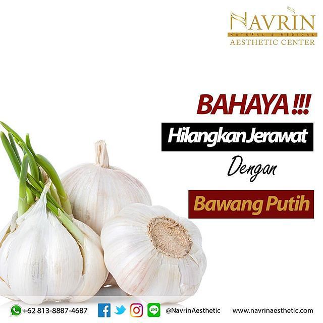 Bahaya Hilangkan Jerawat Dengan Bawang Putih