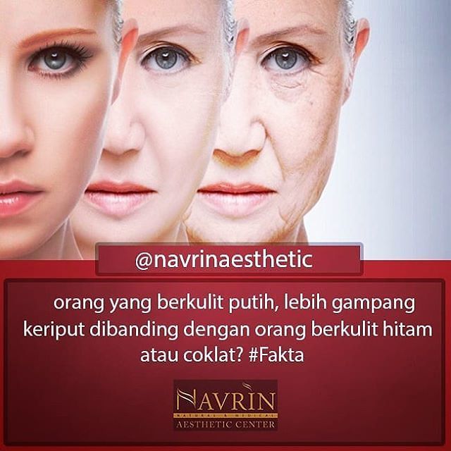 Orang Berkulit Putih Lebih Gampang Keriput