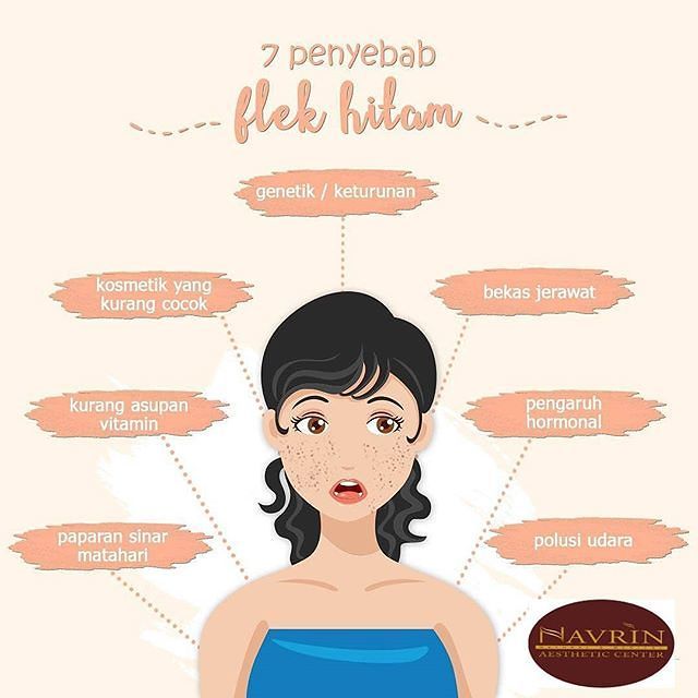 7 Penyebab Flek Hitam
