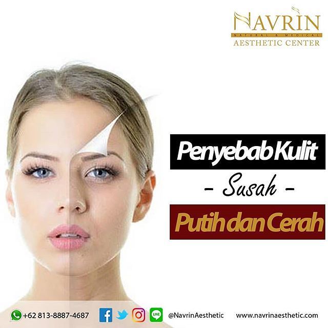  Penyebab Kulit Susah Putih dan Cerah
