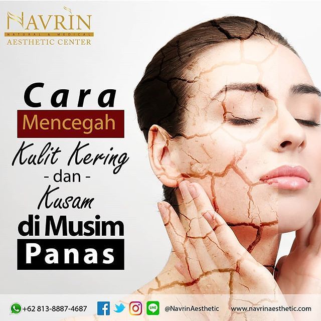 Cara Mencegah Kulit Kering Dan Kusam