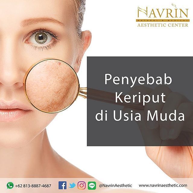 Penyebab Keriput Usia Muda