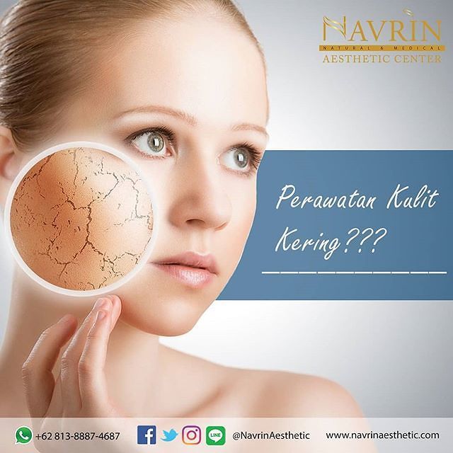  TIPS UNTUK MENGATASI KULIT KERING
