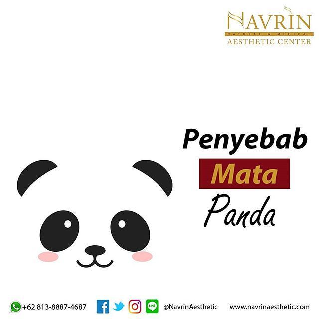 Penyebab Mata Panda