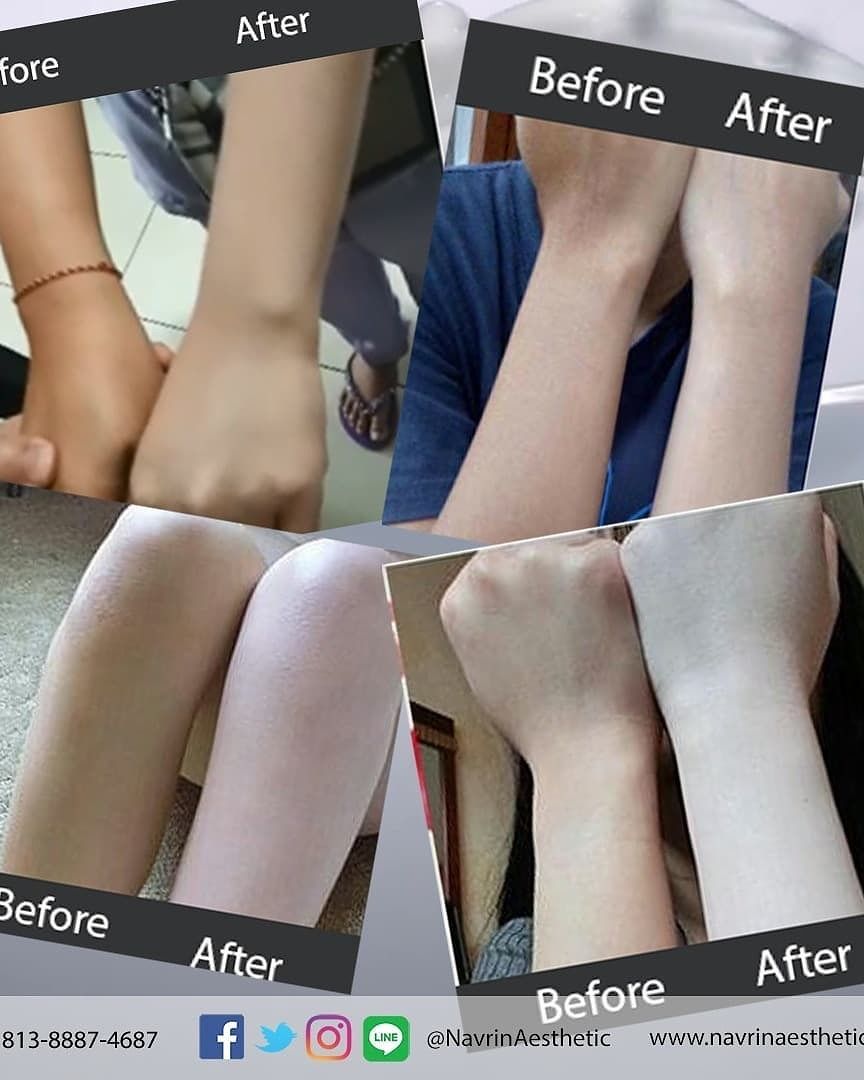 Navrin Whitening Milk Spray SPF 50
