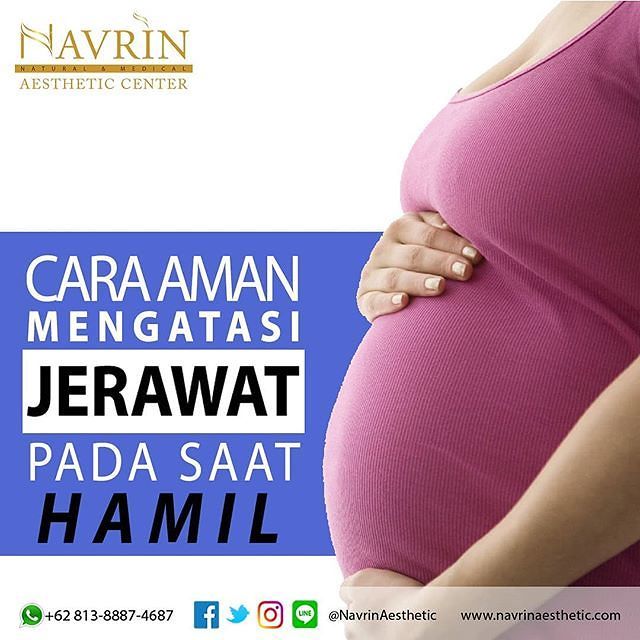 Cara Mengatasi Jerawat Saat Hamil