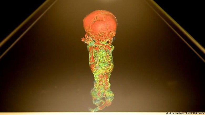 Hologram di Museum Jerman Ungkap Misteri di Balik Mumi