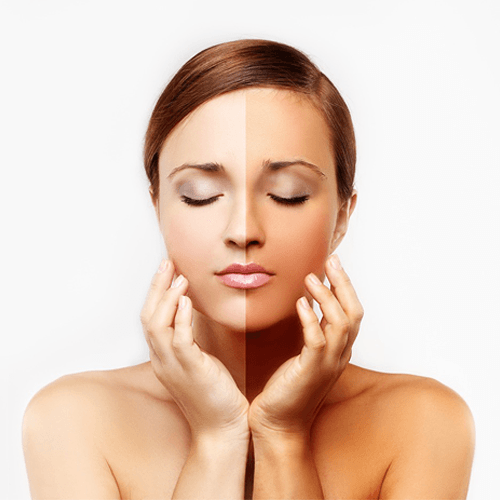 Hilangkan Kulit Kusammu dengan Golden Cocoon Mask