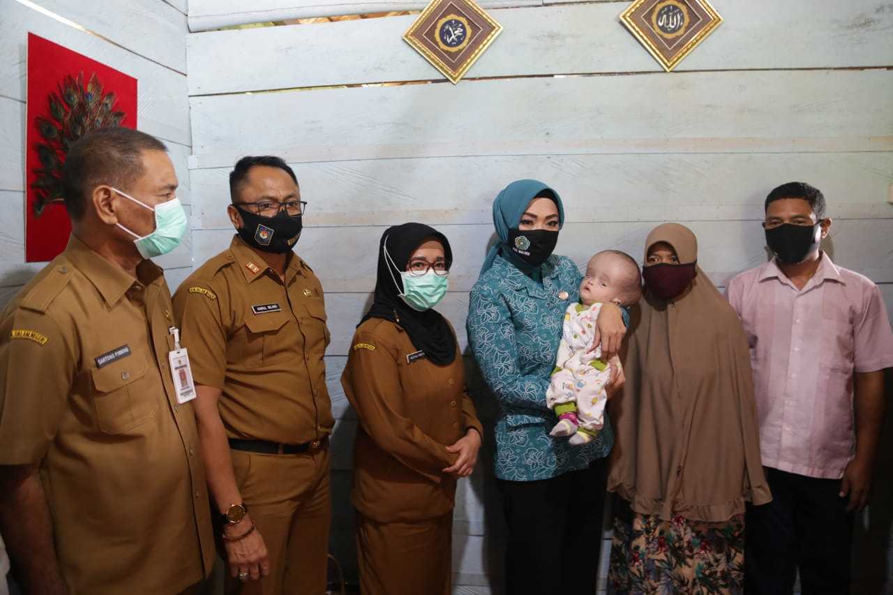 Widya Kunjungi Bayi Hidrosefalus di Hila